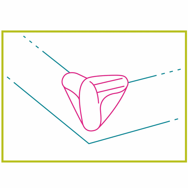 Protection coin de table par fixation adhésive - Nordlinger Pro - Plastique transparent - Lot de 4